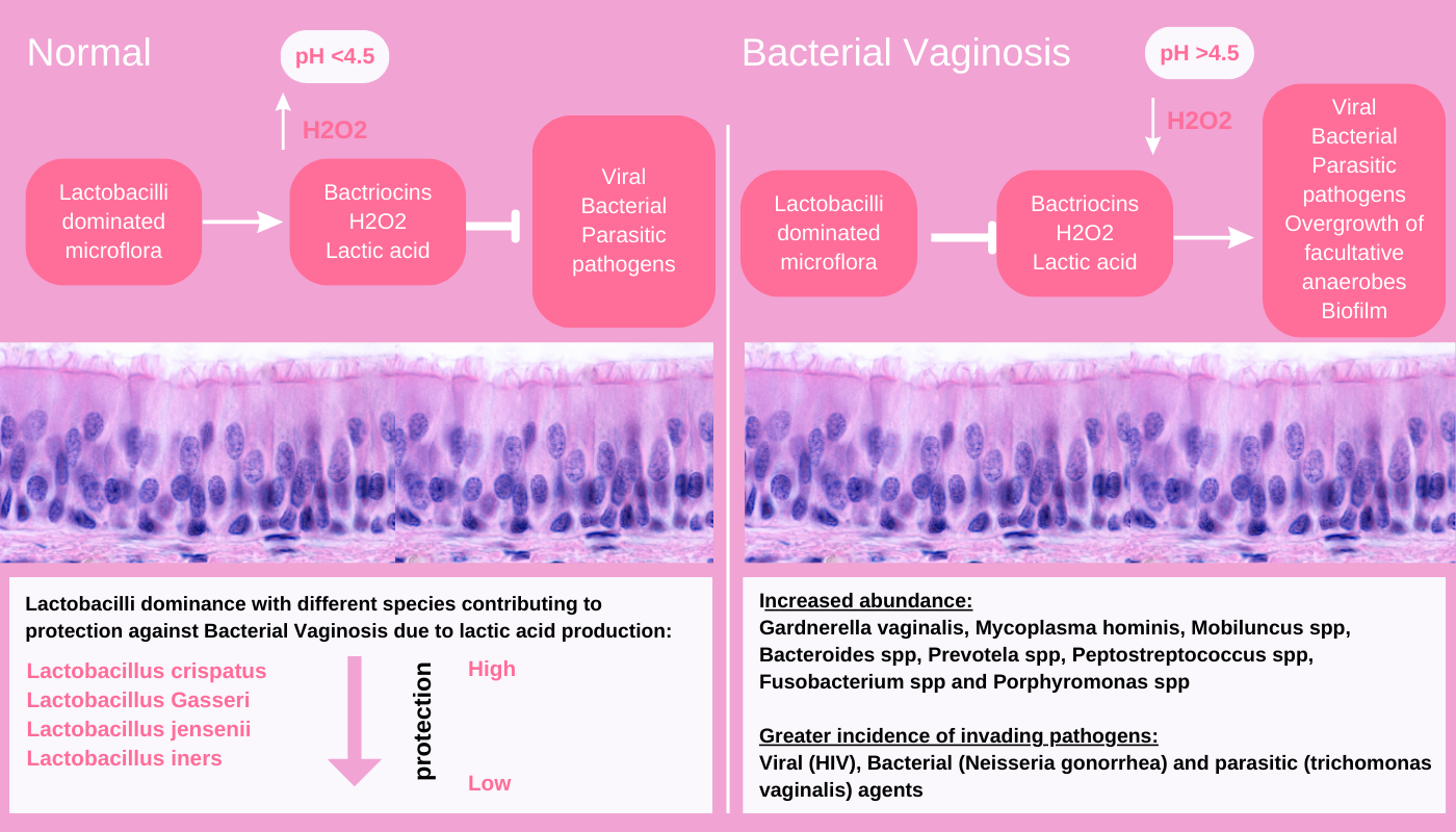 normal-microbiome-vs-bacterial-vaginosis