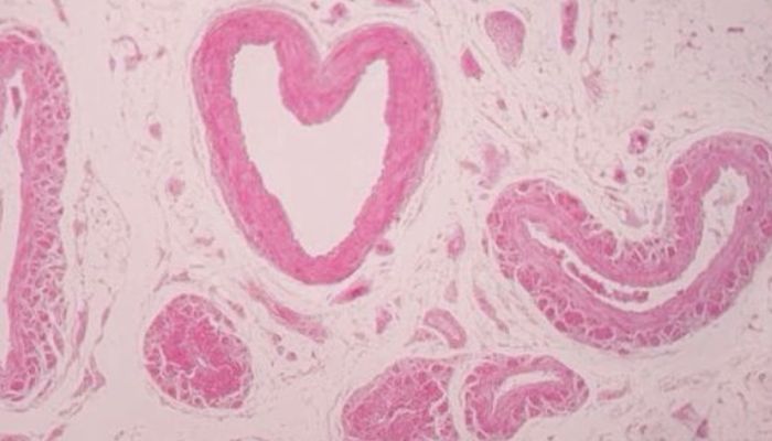 FERTILYSIS Inflammation Index